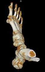 X14-Foot-CT-02.JPG X14-Foot-CT-02.JPG