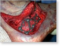 1025-Example Surgery.jpg