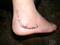 1419-Foot at 5 wks-04.JPG