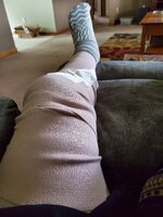Knee%20Surgery-X5.jpg