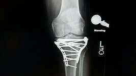 Knee -2 -   3-12-19.jpg