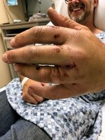 crash-ring-finger.jpg