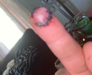 finger1.jpg finger1.jpg