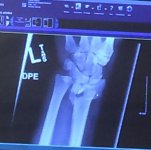 Arm 3.jpg
