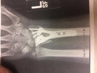 Arm 4.jpg
