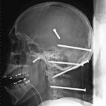 nail-skull.jpg